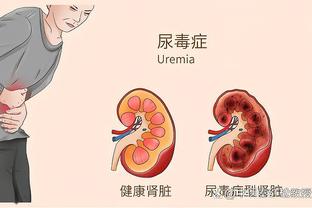 太阳官方：布克将因右脚踝扭伤缺席对阵凯尔特人的比赛